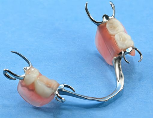 Tips Merawat Gigi Palsu Lepasan agar Tidak Bau