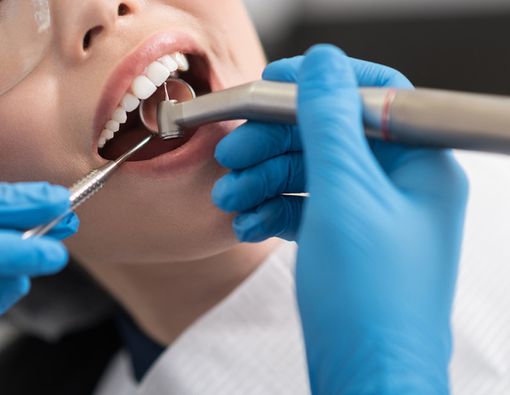 Mengenal Metode Kuretase pada Gigi