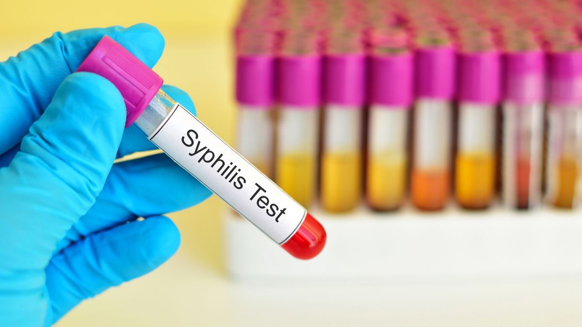 Apa Saja Gejala Sifilis pada Wanita?