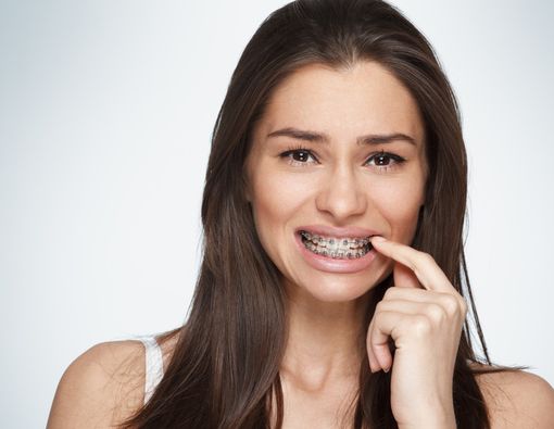 Cara Tepat Atasi Kawat Gigi Longgar