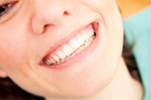 Atasi Gigi Ngilu Setelah Dental Bleaching
