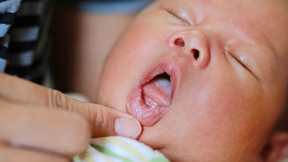 Masalah Kesehatan Mulut yang Sering Terjadi pada Bayi