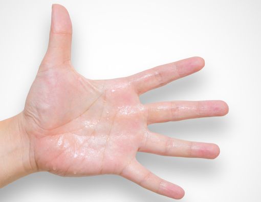 Telapak Tangan Sering Berkeringat? Ini Penyebabnya