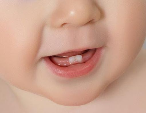 Tanda-Tanda Si Kecil Akan Tumbuh Gigi