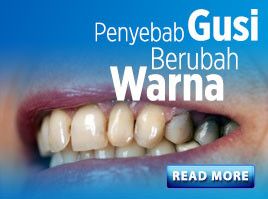 Penyebab Gusi  Berubah Warna