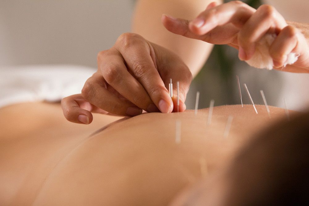 Adakah Efek Samping Akupunktur bagi Kesehatan? (Studio 72/Shutterstock)