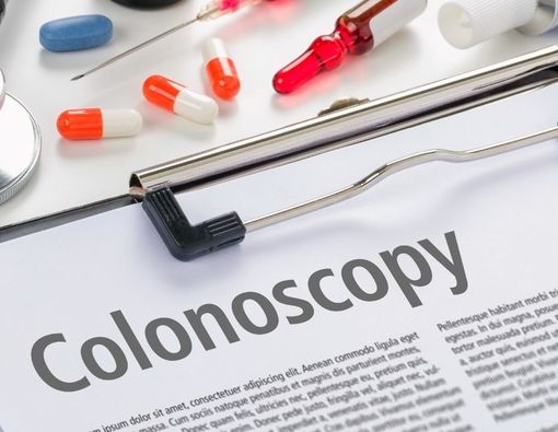 Hal yang Harus Anda Ketahui tentang Kolonoskopi