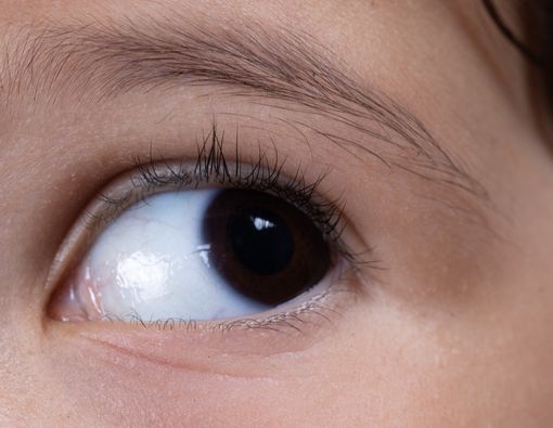 Penyebab dan Cara Mengatasi Nistagmus pada Penglihatan