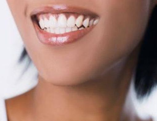 Mengapa Gusi Berwarna Gelap?