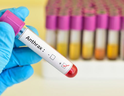 Warga Yogyakarta Terserang Antraks, Ini Risiko dan Perawatannya