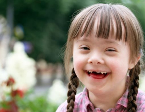 5 Aktivitas Sehat untuk Anak dengan Sindrom Down