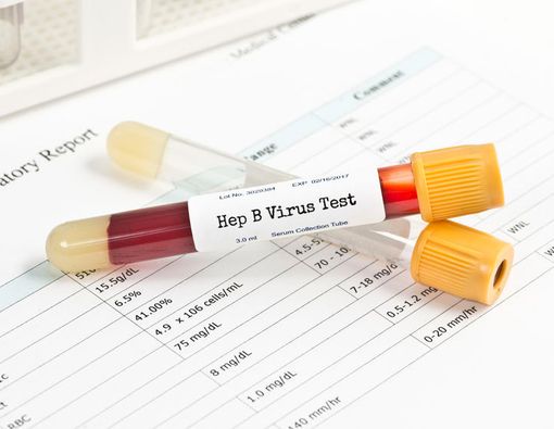 Cek di Sini Gejala Hepatitis