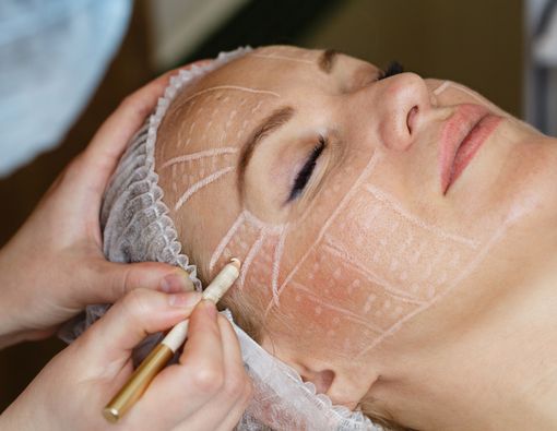 Mengenal Facelift, Prosedur yang Bikin Muda Kembali