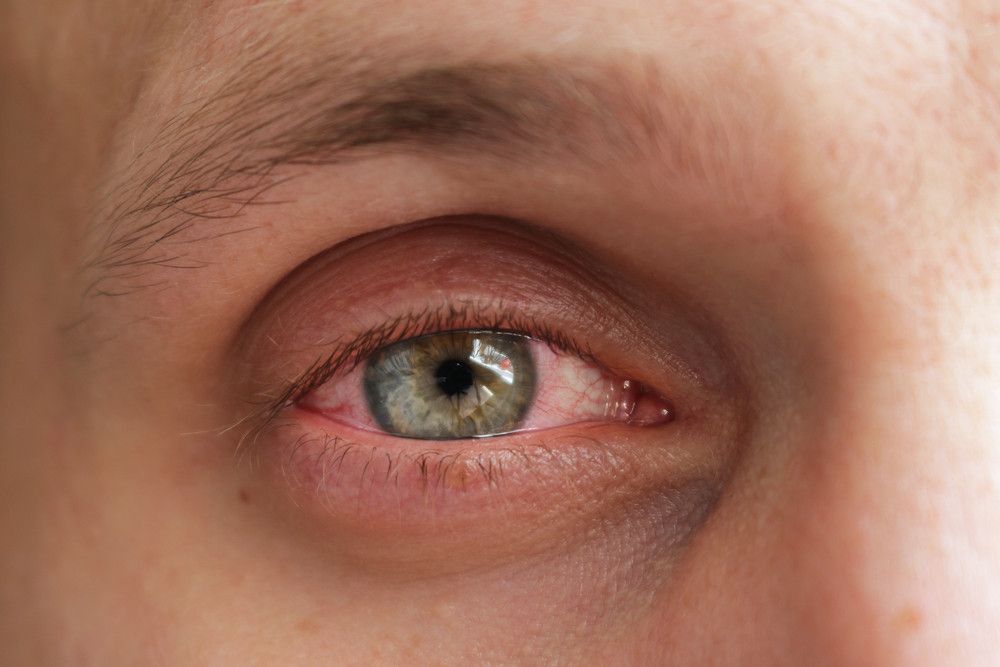 5 Masalah Kesehatan Ini Bisa Dideteksi dari Mata