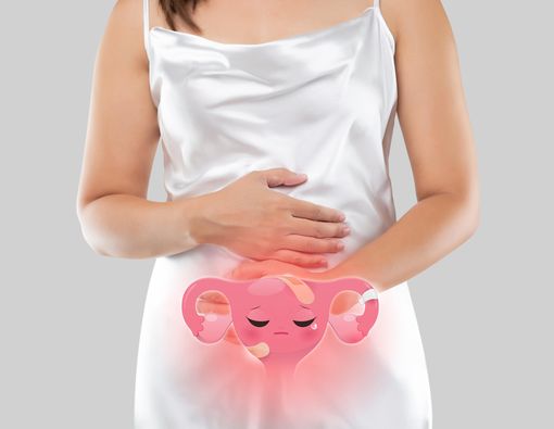 Benarkah Risiko Endometriosis Meningkat Akibat Kekurangan Vitamin D?