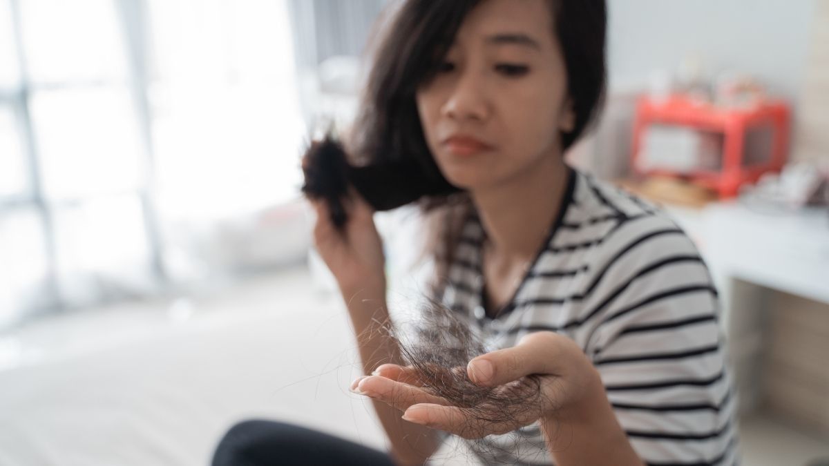 Beragam Faktor Risiko Alopecia Areata