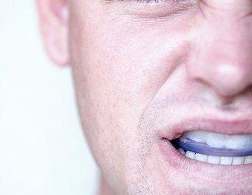Mouth Guard, Si Pelindung Mulut
