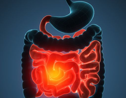 Makanan Sehat Ini Efektif Mencegah Kanker Usus