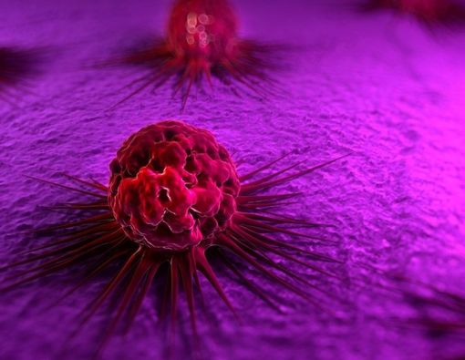 Jenis Kanker Paling Mematikan di Indonesia