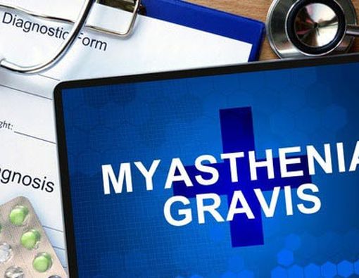Mengenali Gejala Awal  Myasthenia Gravis