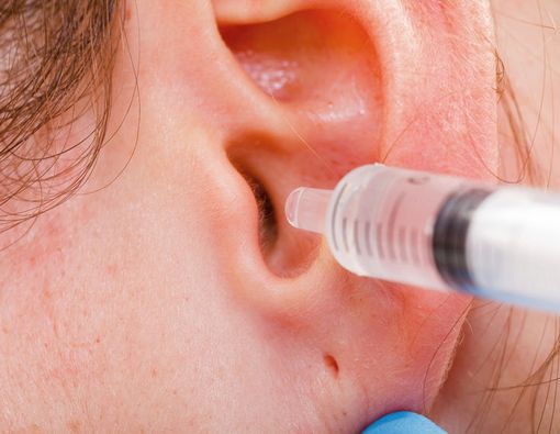 Mengatasi Serumen Prop, Penyebab Rasa Mengganjal di Telinga