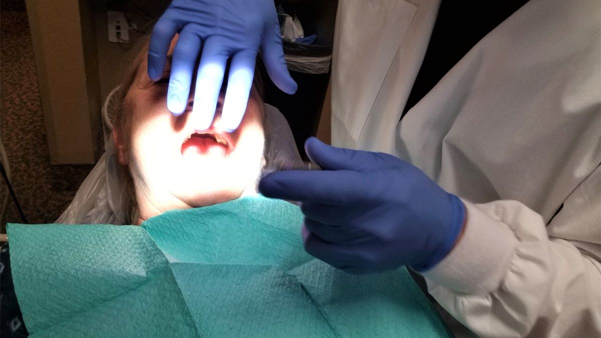 Mengenal Oral Myiasis, Infeksi Belatung di Dalam Mulut