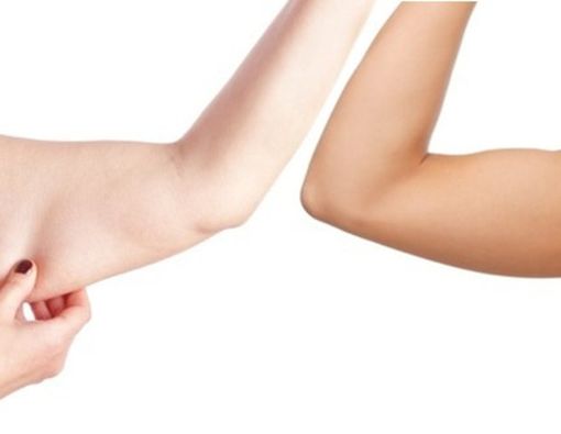 Cara Mengencangkan Lengan yang Efektif untuk Anda