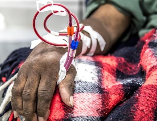 Penyakit Ginjal Sebabkan Kulit Menghitam, Ini Alasannya