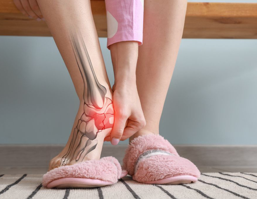 Penyebab Tumit Sakit saat Bangun Tidur