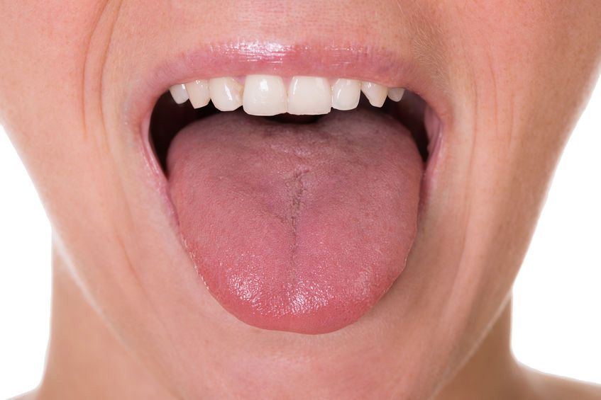 Penyebab Mulut Terasa Asam, Apakah Berbahaya?