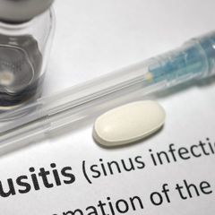 7 Jenis Obat untuk Mengatasi Sinusitis
