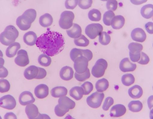 Mengenal Basofil dan Fungsinya untuk Manusia