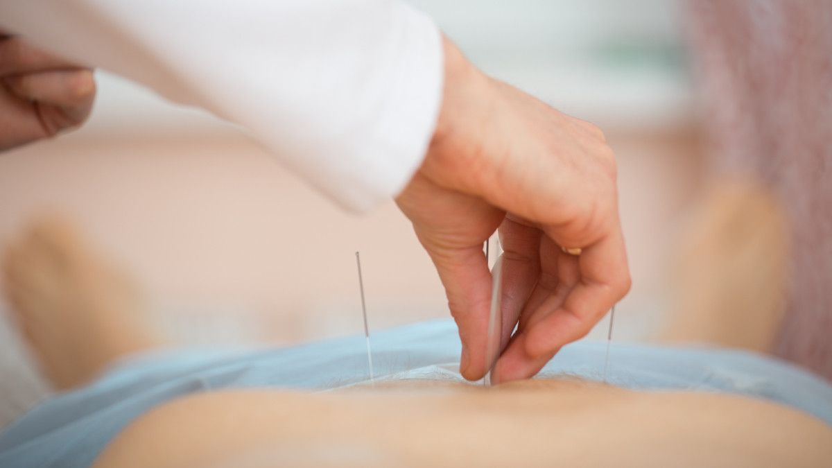 Terapi Akupunktur Untuk PCOS, Efektifkah? (Borkin-Vadim/Shutterstock)