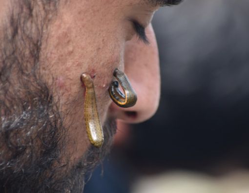 Efektikah Minyak Lintah untuk Menghilangkan Jerawat Secara Alami?