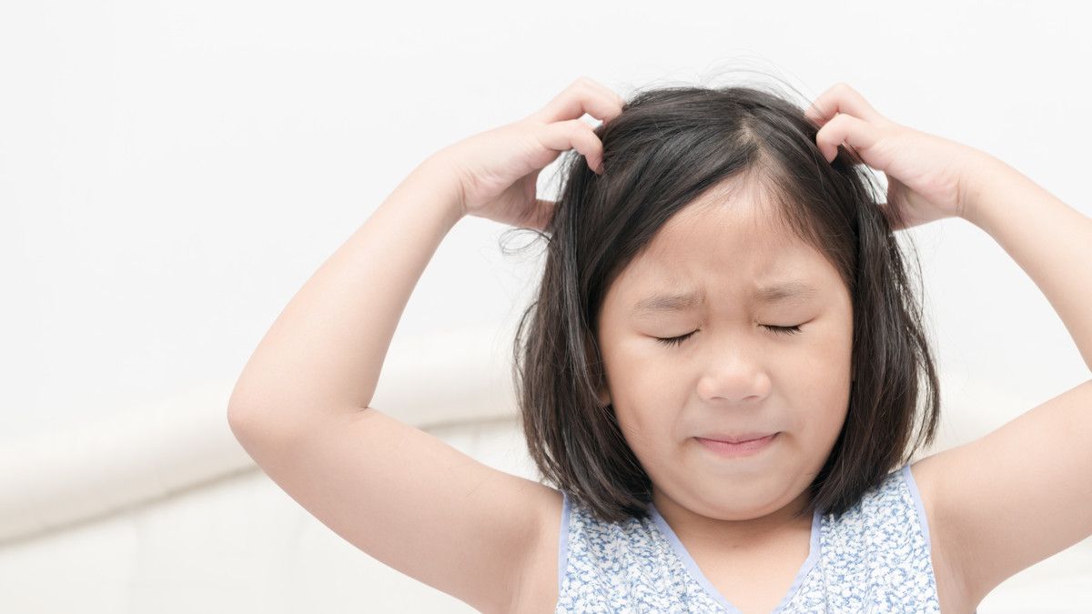 Muncul Ketombe pada Anak, Atasi dengan Cara ini