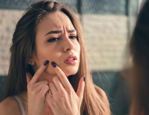 Cara Mudah Lenyapkan Bekas Jerawat