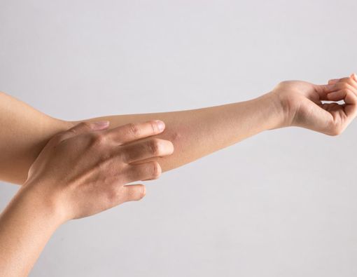 Awas, Bentol Kecil Bisa Jadi Gejala Kanker Sarkoma Ewing