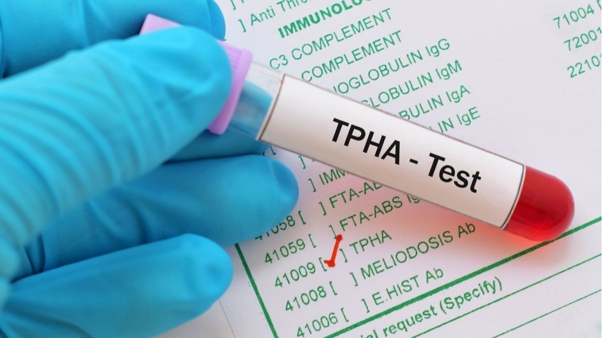 Mengenal Tes TPHA, Skrining Penyakit Sifilis