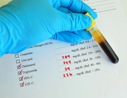 Kolesterol dan Trigliserida Tinggi? Awas Diabetes!