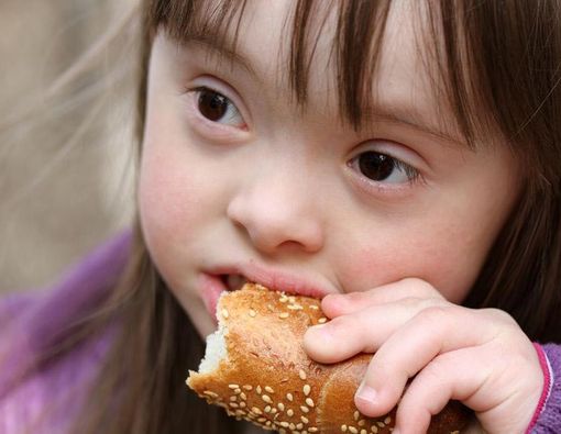 Asupan Gizi untuk Anak Sindrom Down