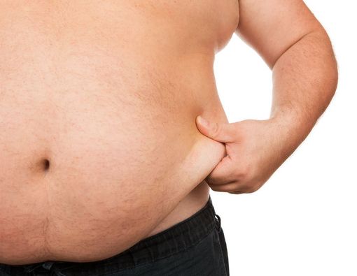 Badan Gemuk Berisiko Tinggi Pengapuran Sendi