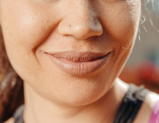 Cara Mengatasi Kerutan di Sekitar Mulut