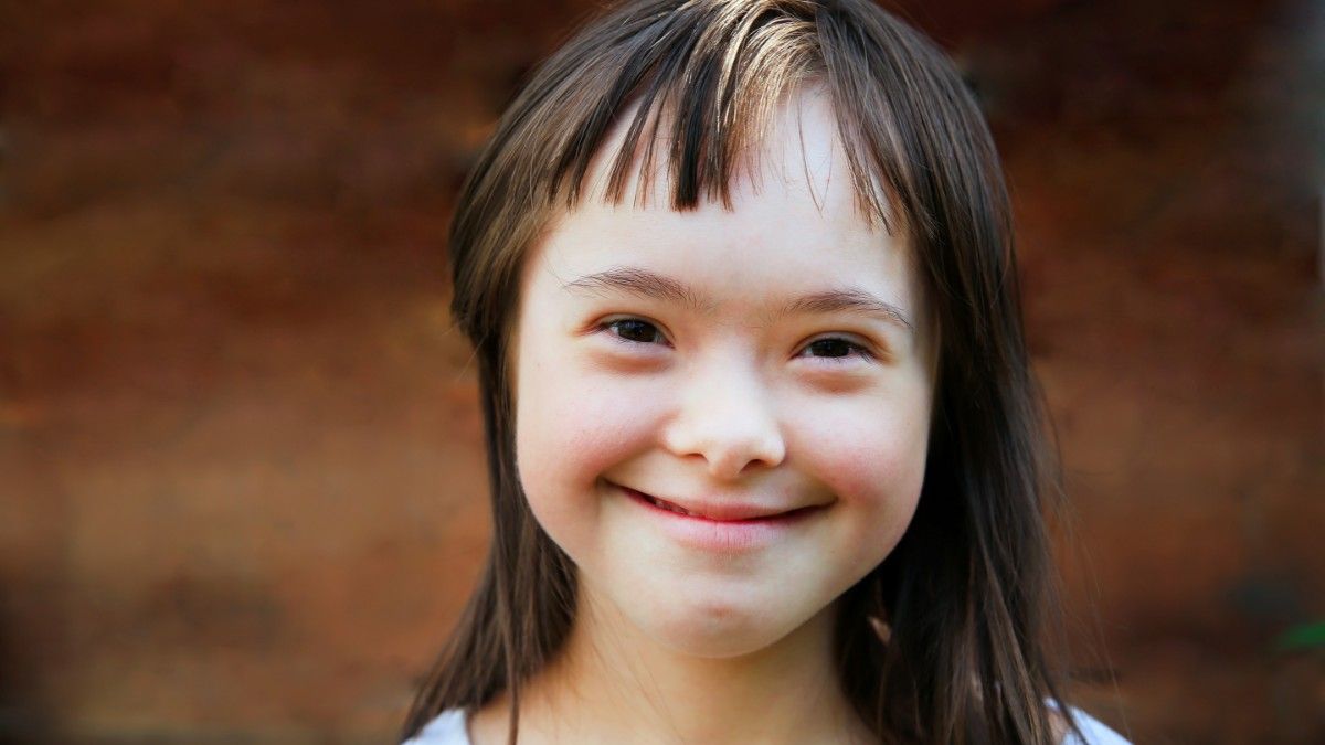 Mengapa Anak Down Syndrome Memiliki Wajah yang Khas?
