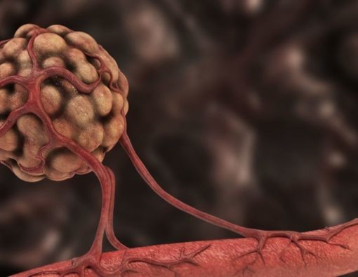 Mengenal Angiogenesis dan Hubungannya dengan Kanker