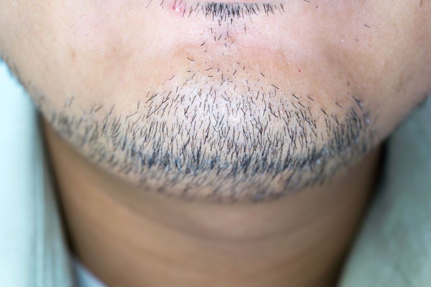 Adakah Manfaat Menumbuhkan Kumis dan Jenggot bagi Kesehatan Pria?