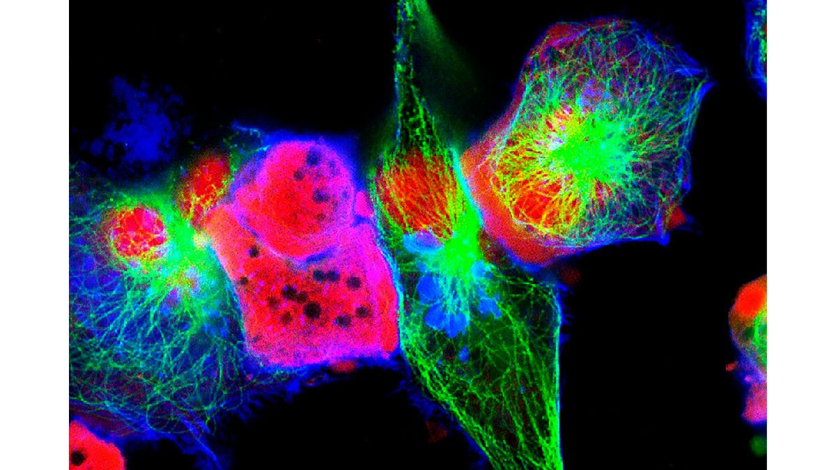 Daftar Pengobatan Penyakit Neuroblastoma