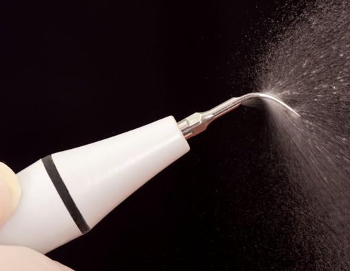 Gunakan Alat Pembersih Karang Gigi Sendiri, Amankah?