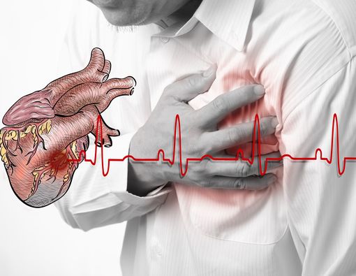 10 Penyebab Kematian Terbanyak di Dunia