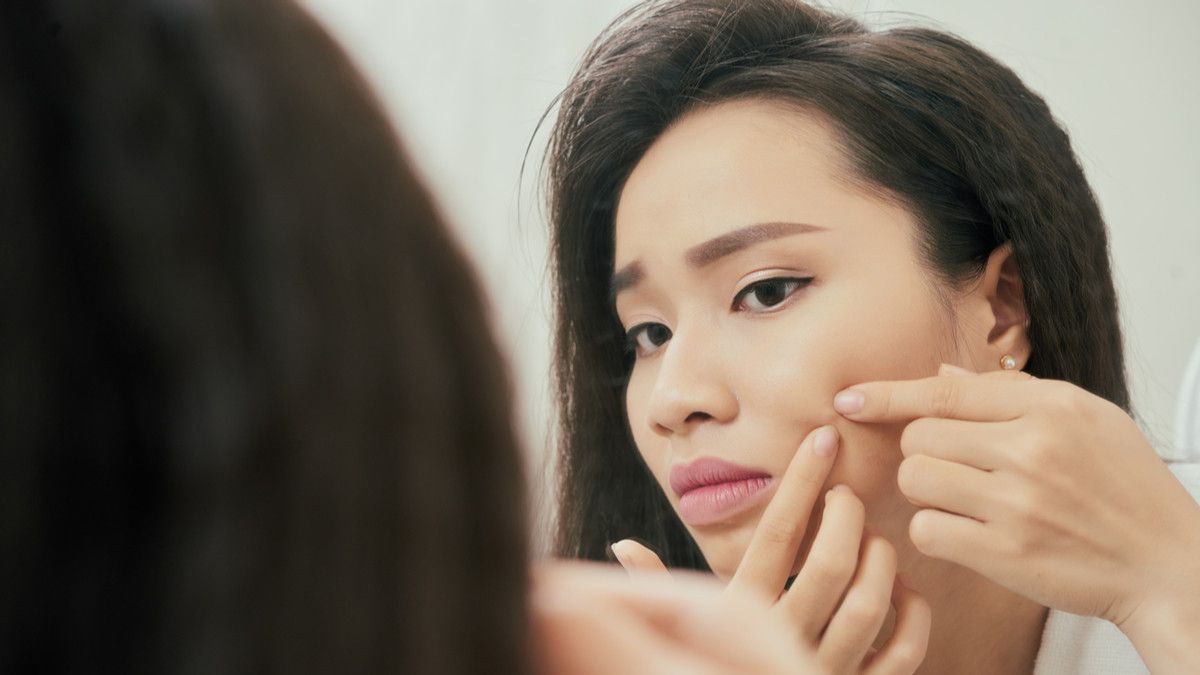 Terlanjur Pencet Jerawat? Segera Lakukan Hal Ini