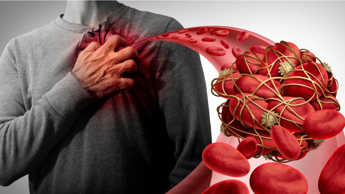 Hati-Hati, Pasien Virus Corona Bisa Alami Pembekuan Darah Misterius